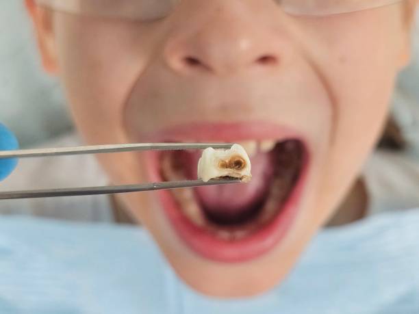 Best Tooth Pain Emergency Relief  in Meggett, SC