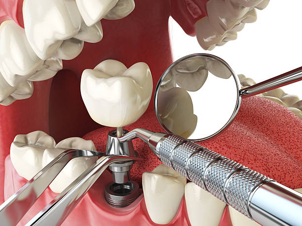 Best Urgent Tooth Repair  in Meggett, SC